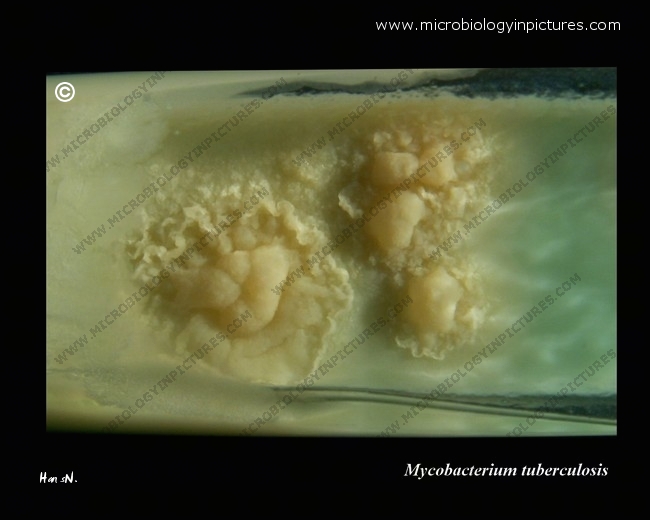 Image of Mycobacterium tuberculosis culture growing on LJ medium